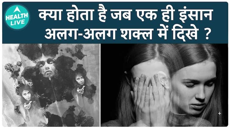 फ्रेगोली सिंड्रोम क्या है? इस दुर्लभ स्थिति को समझना